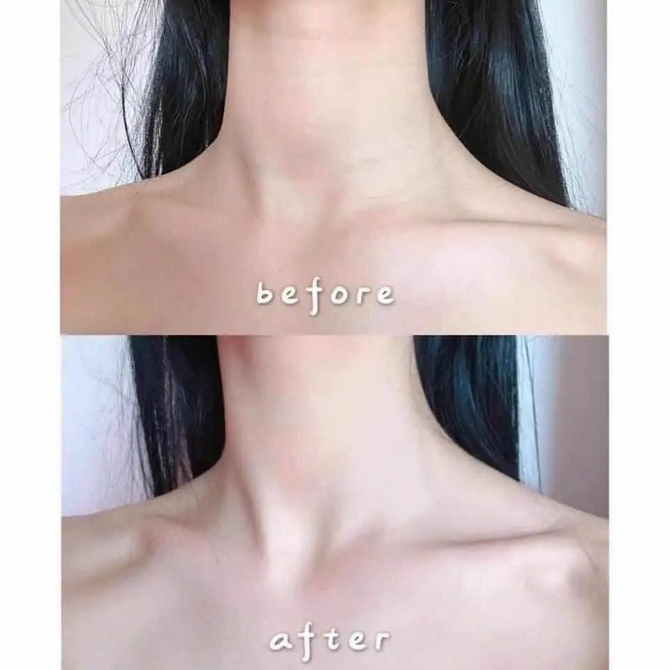 【一口價$128/盒】韓國🇰🇷VELLA 深層撫紋熨斗頸膜(5gx5片)一盒 - HLY & CHOCCICO