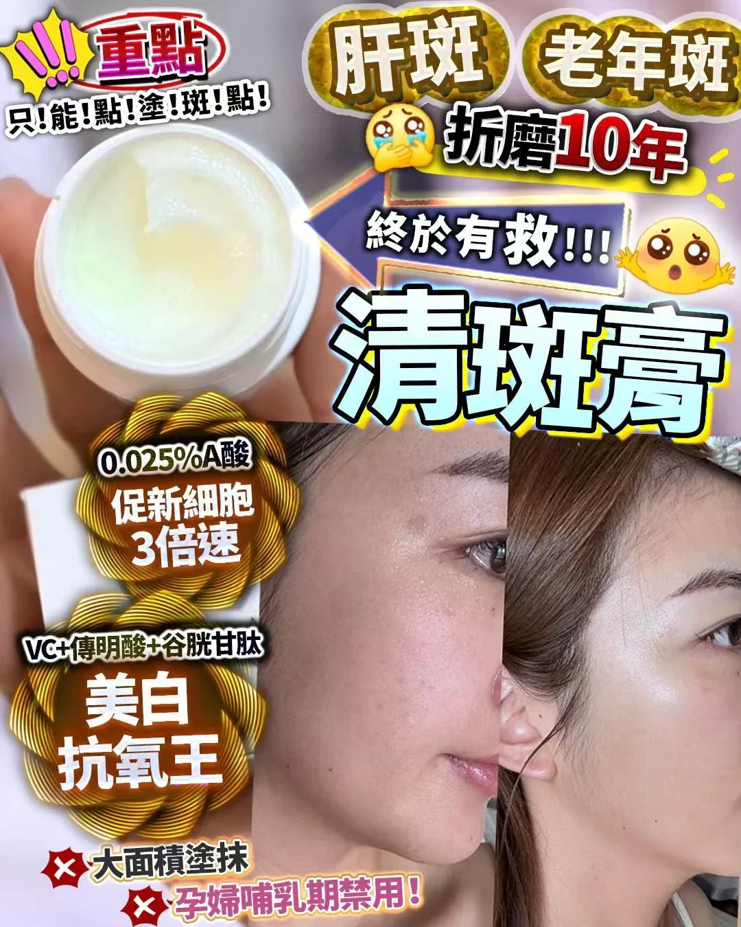 清斑膏 15g 重點塗抹 - HLY & CHOCCICO