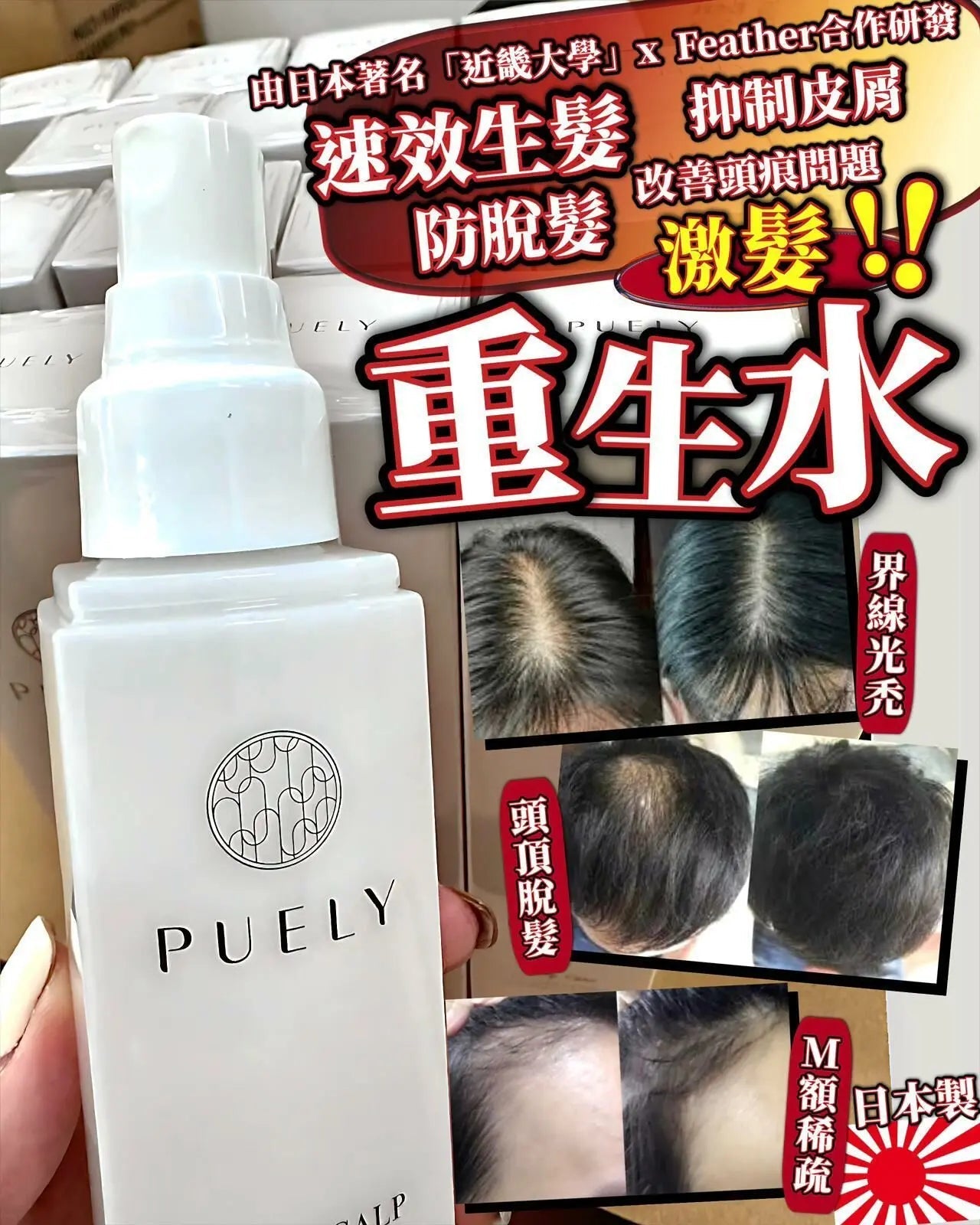 【一口價$298/支】日本Puely 激髮‼️ 重生水 120ml - HLY & CHOCCICO