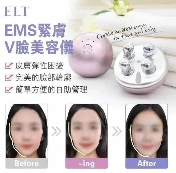 【一口價$688/部】ELT EMS 緊膚V臉美容儀 🇭🇰行貨1年保養🇭🇰 - HLY & CHOCCICO