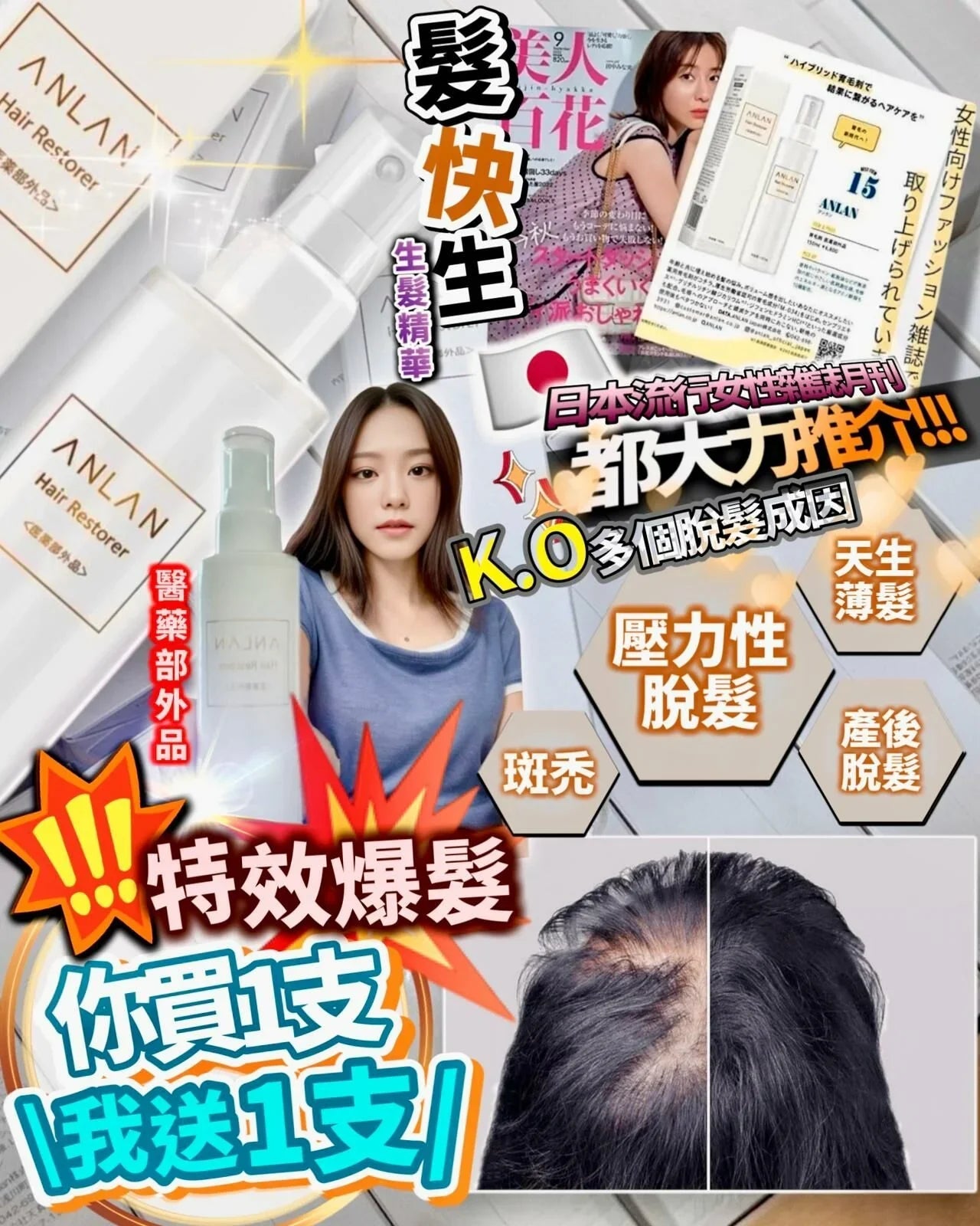 Anlan 髮快生 育髮精華 150ml‼️買1送1‼️ - HLY & CHOCCICO