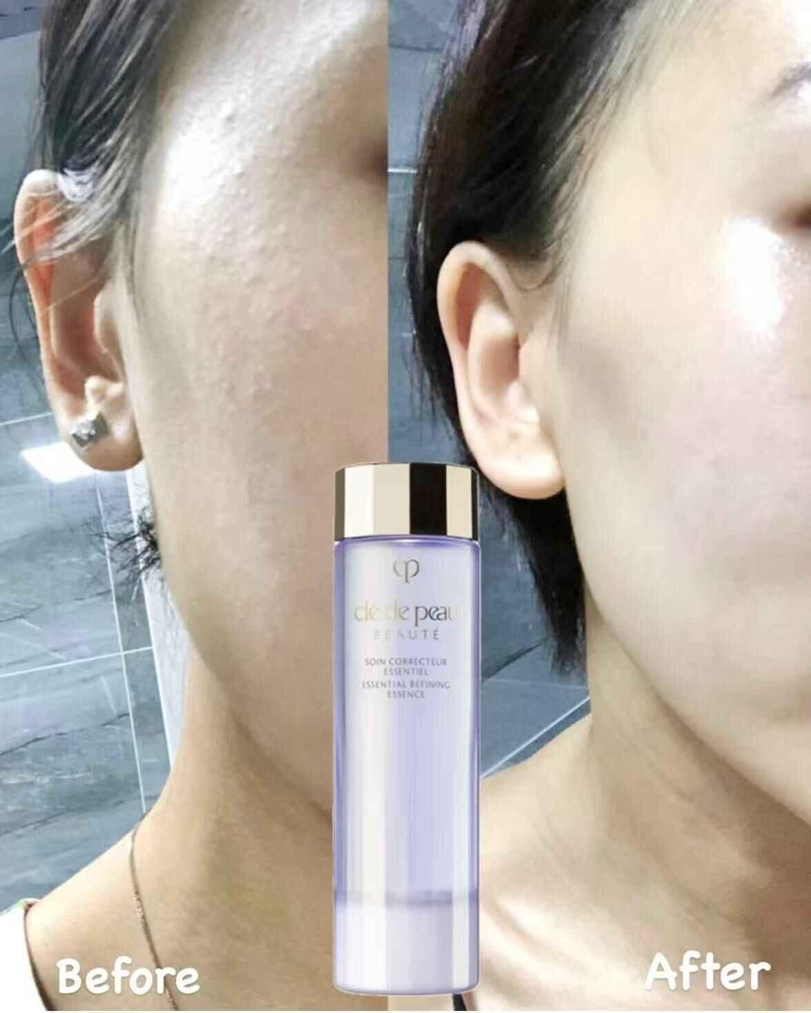 Cle De Peau Cdp 肌膚之鑰極致無瑕精華水 (水磨精華) 170ml (免稅貨) - HLY & CHOCCICO