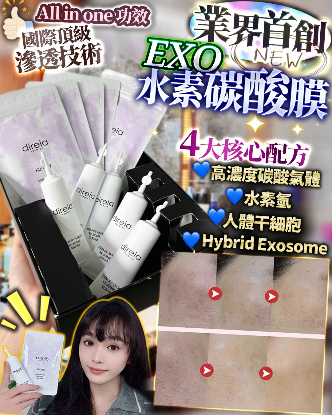日本制 Direia 外泌體水素炭酸 (一盒5回 ) - HLY & CHOCCICO