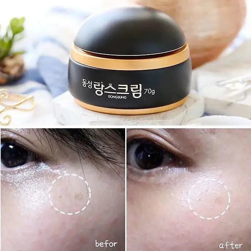 韓國東星 DongSung Rannce Cream 小黑瓶70g 💢買一送一💢 - HLY & CHOCCICO