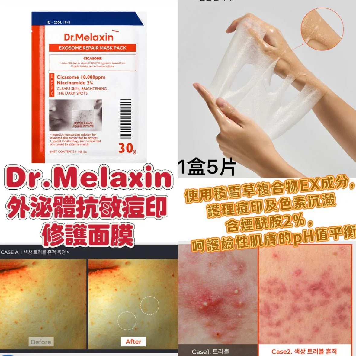 Dr.Melaxin 外泌體抗敏痘印修護面膜 5片 - HLY & CHOCCICO