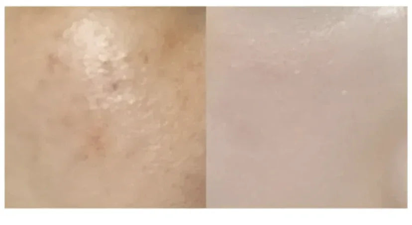 ★ Dr.Melaxin 逆齢專家 TX 超強 去角質美白爽膚水 150ml - HLY & CHOCCICO