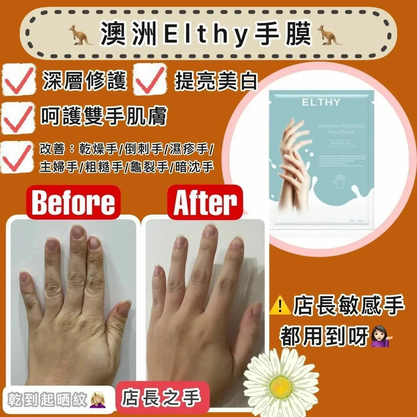 澳洲🦘Elthy 還原靚靚貴婦手膜 (1盒6對) ❗❗買一送一❗❗ - HLY & CHOCCICO