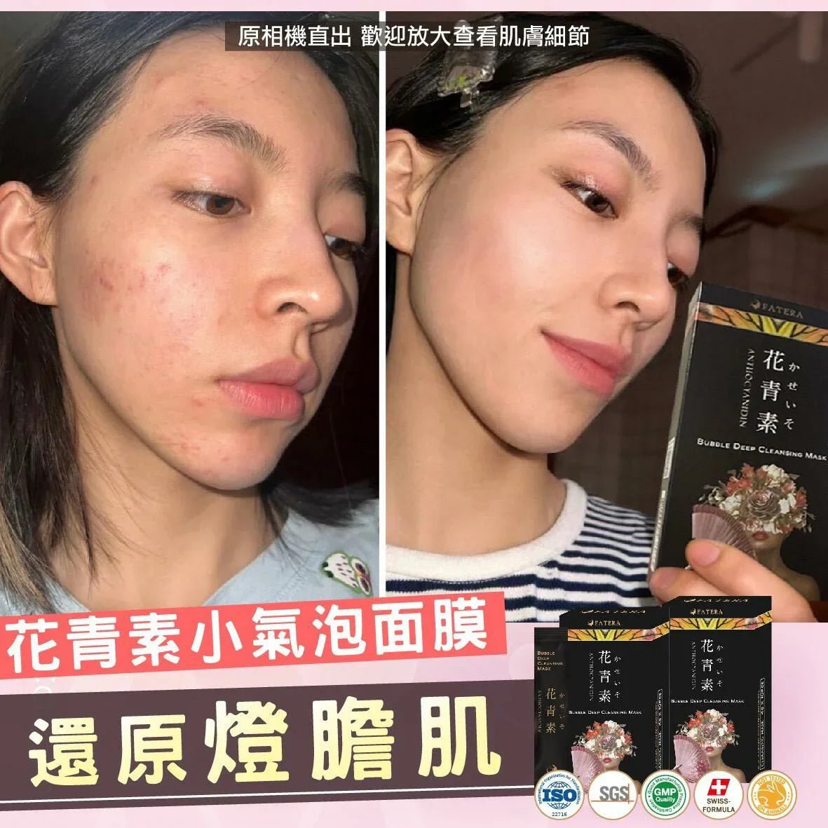 Fatera花青素小氣泡面膜 - HLY & CHOCCICO