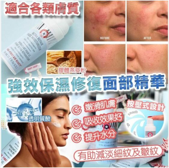 First Aid Beauty Ultra Repair Hydrating serum 急救美人強效保濕修護面部精華50ml - HLY & CHOCCICO
