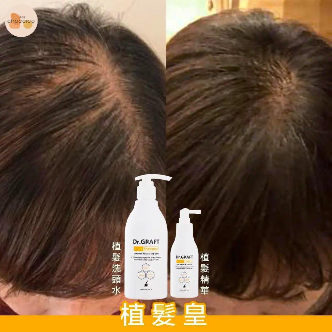 韓國🇰🇷Dr.GRAFT 植髮皇 孕育洗頭水300ml/ 孕育精華100ml HLY & CHOCCICO