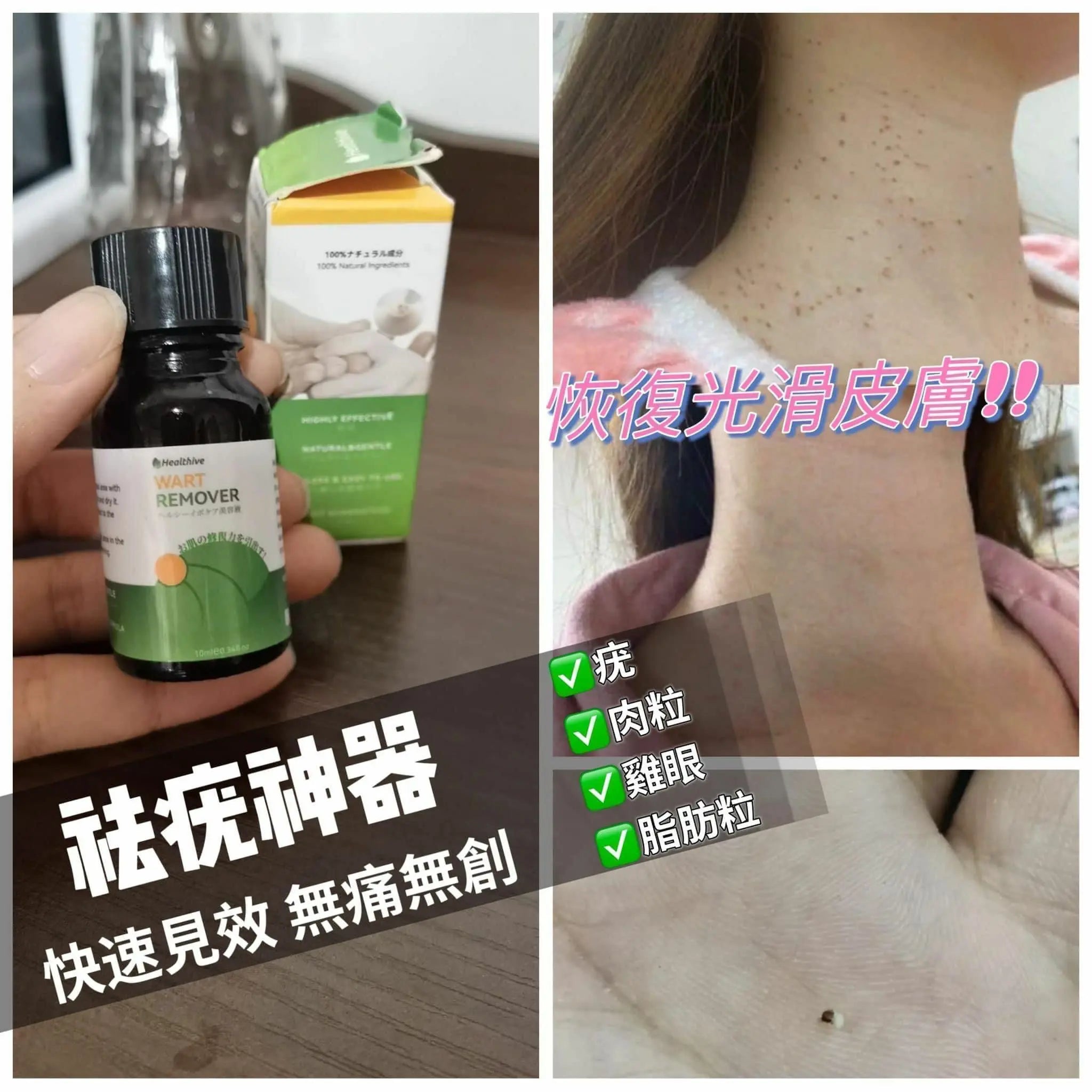 【一口價$170/支】日本🇯🇵 Healthive 除疣精華液 (10ml) HLY & CHOCCICO