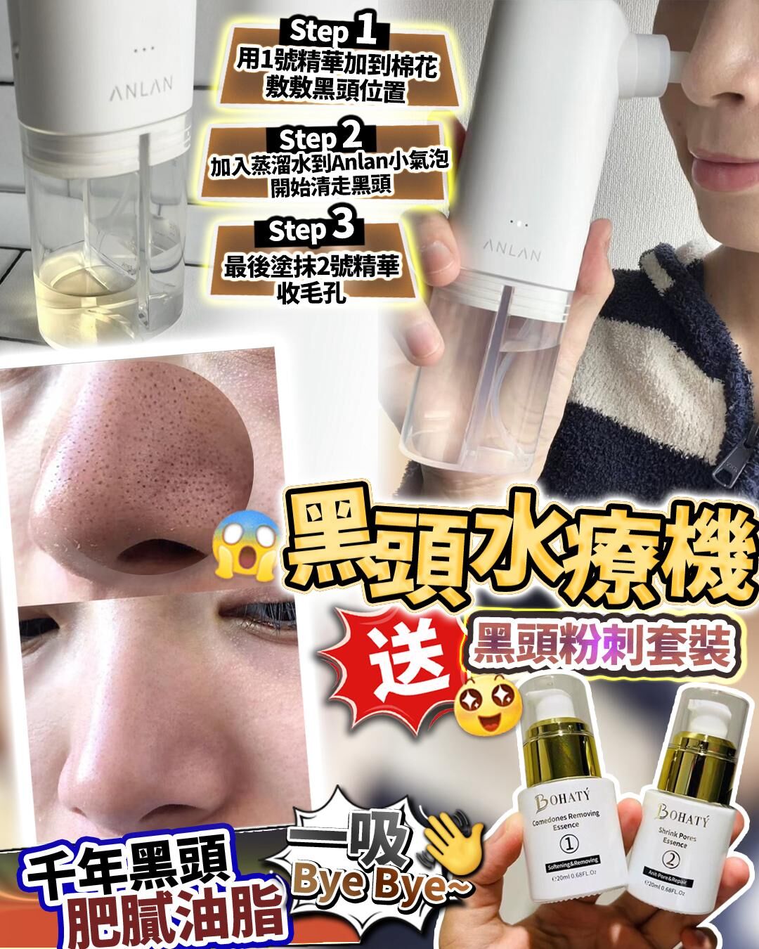 Anlan黑頭水療機 送黑頭套裝 HLY & CHOCCICO