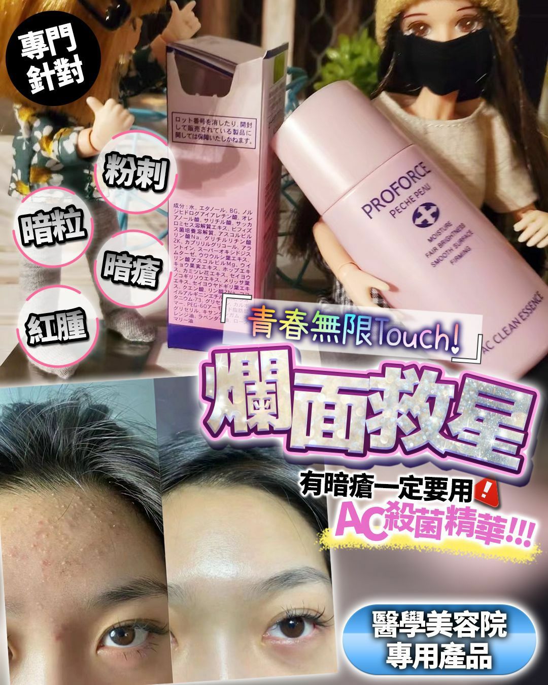 日本醫美級別 Proforce AC殺菌精華 - HLY & CHOCCICO