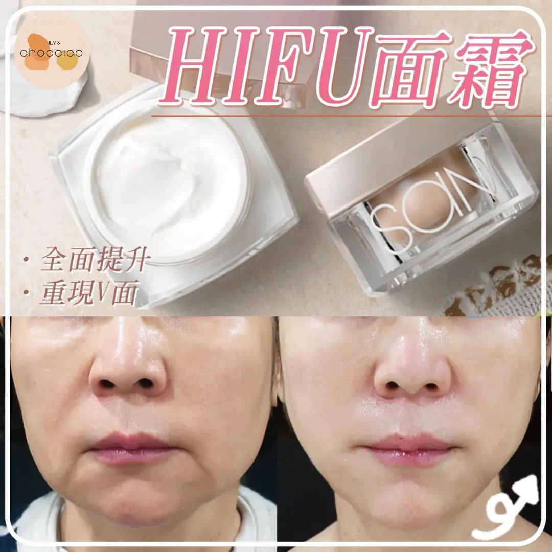 Sandalphone Hifu 面霜 💥買一送一💥 - HLY & CHOCCICO