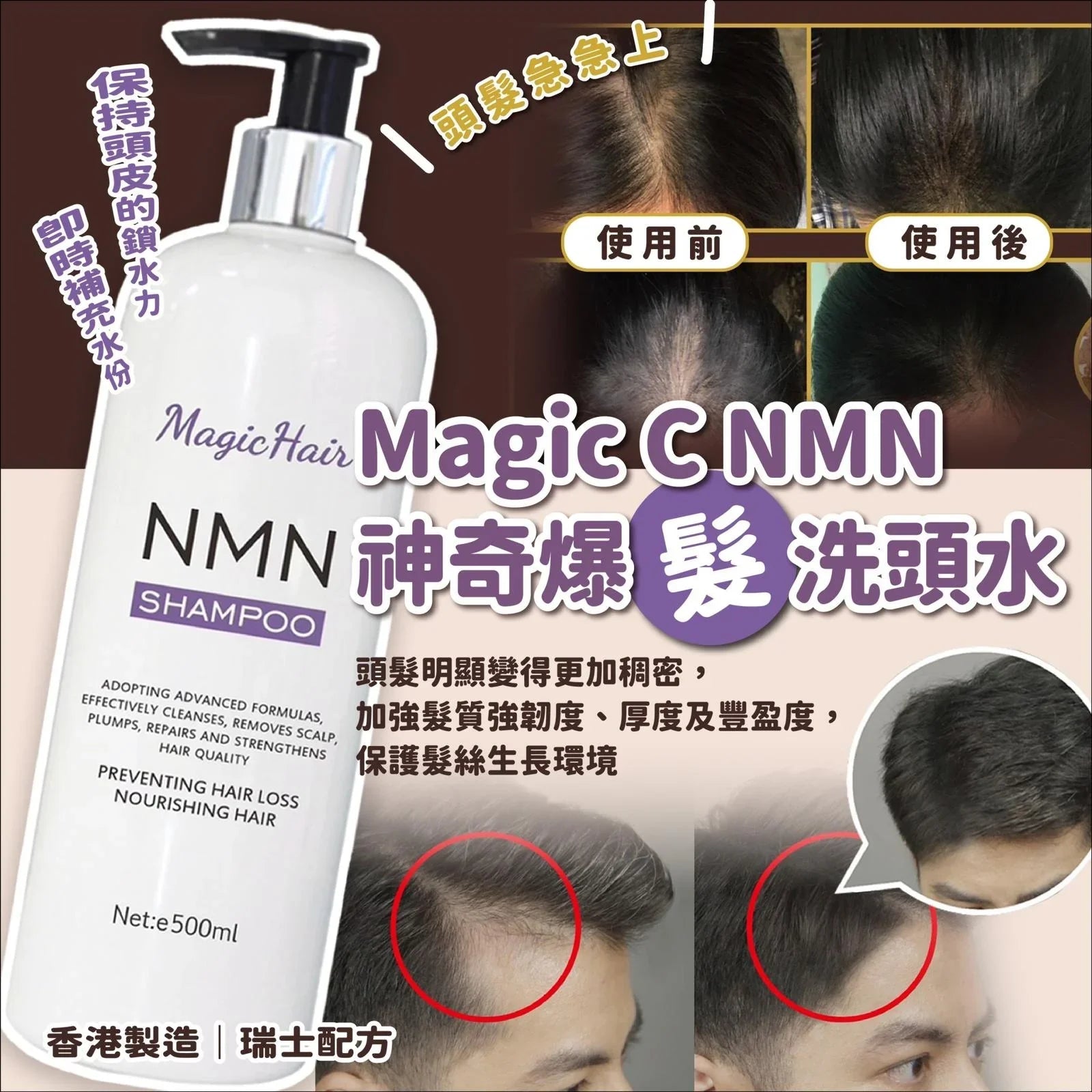 Magic C NMN 神奇爆「髮」洗頭水 - HLY & CHOCCICO