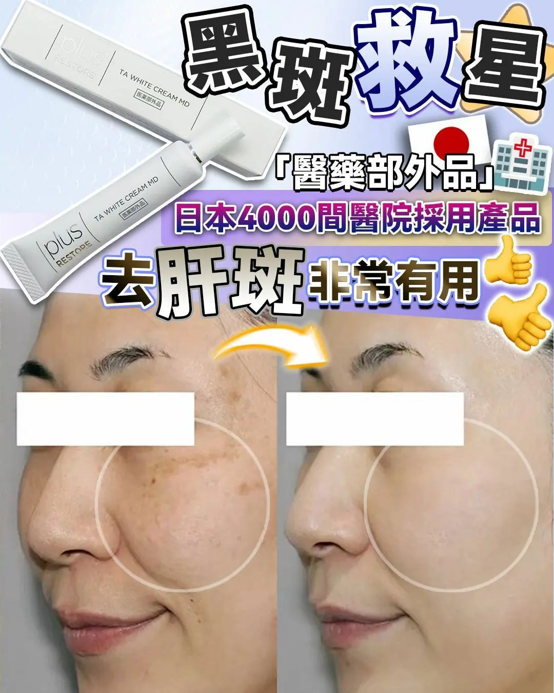 日本 醫療級 黑斑救星 Plus Restore TA White Cream MD 10g - HLY & CHOCCICO