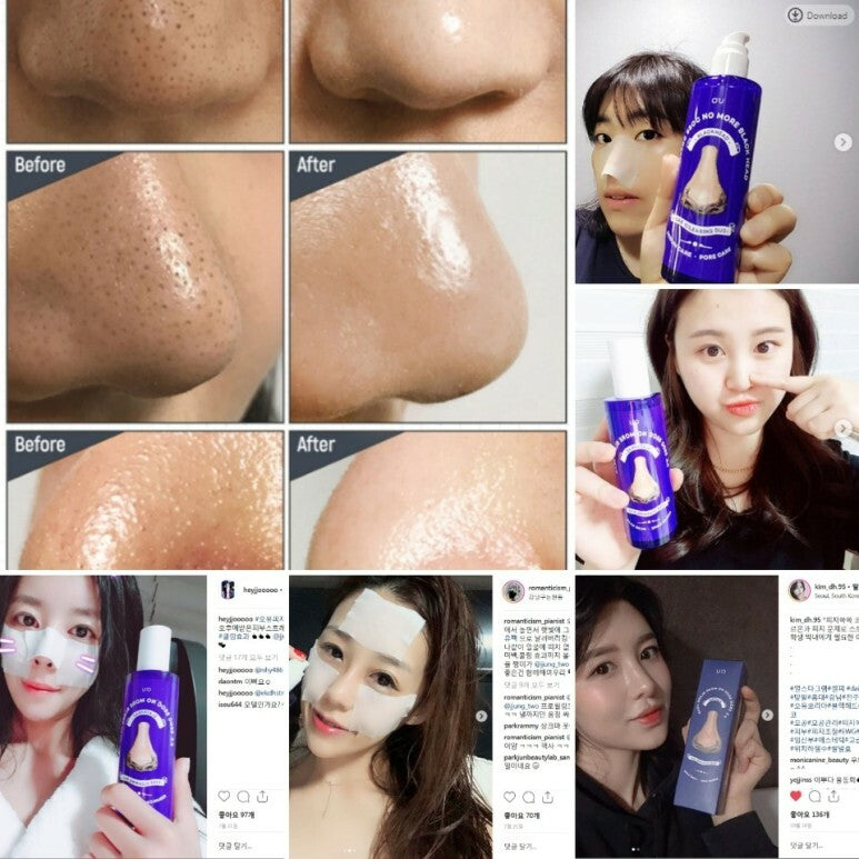 【一口價$135/支】韓國 ONE DAY’S YOU黑頭導出液 100ml