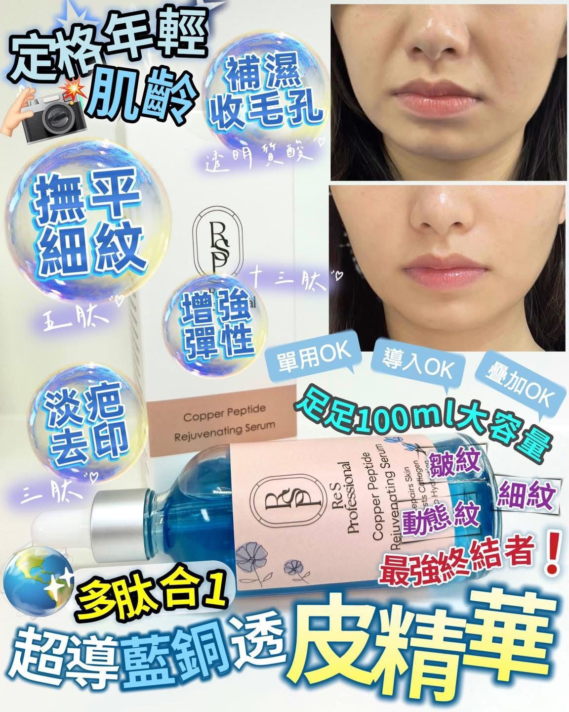 𝑹𝒆 𝑺 𝑷𝒓𝒐超導藍銅透皮精華