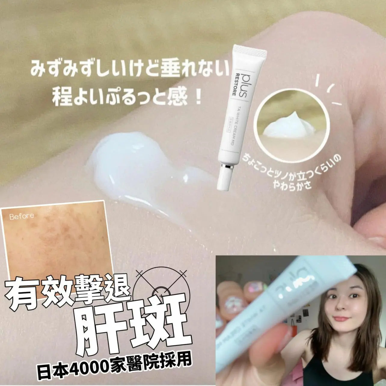 日本 醫療級 黑斑救星 Plus Restore TA White Cream MD 10g - HLY & CHOCCICO