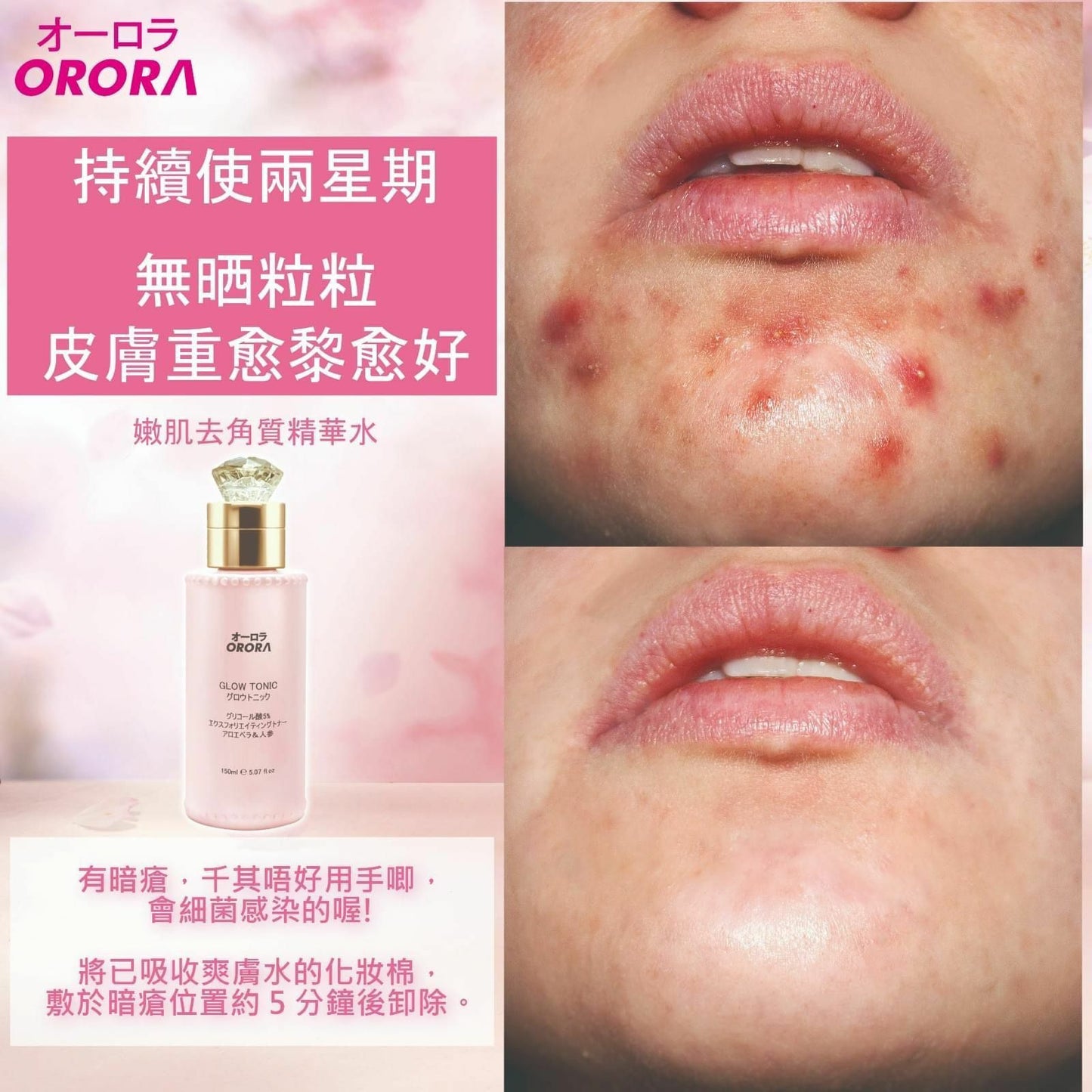 日本🇯🇵ORORA 神仙嫩肌去角質爽膚水150ml
