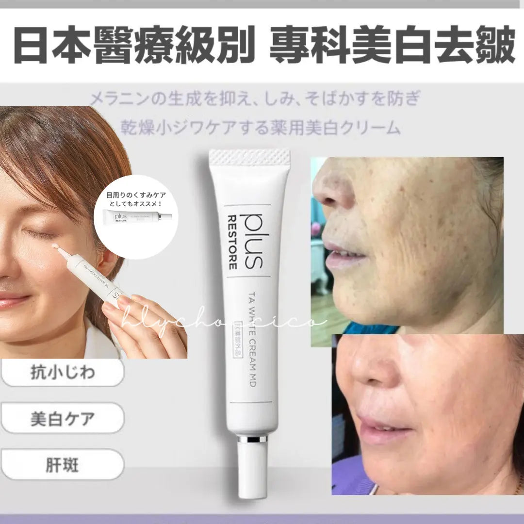 日本 醫療級 黑斑救星 Plus Restore TA White Cream MD 10g - HLY & CHOCCICO