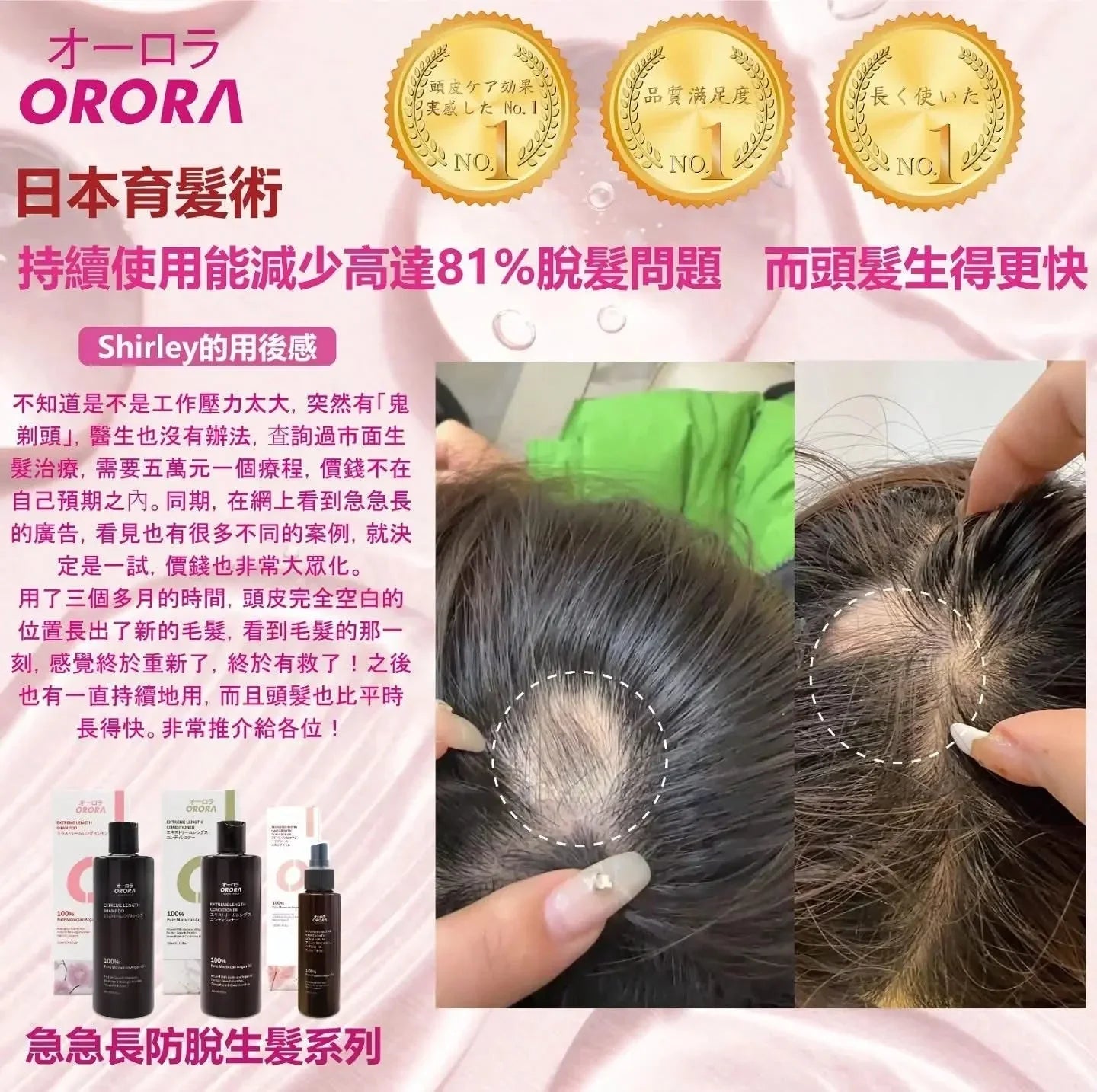 日本🇯🇵ORORA 神級育髮套裝 頭髮急急長洗頭水/ 護髮素 ( 1套2支) - HLY & CHOCCICO