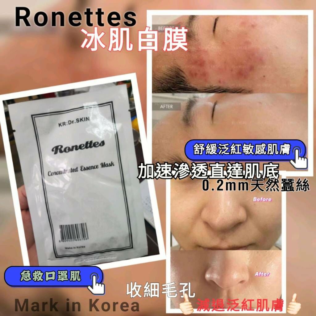 Ronettes 神膜白冰肌 (1包10片) - HLY & CHOCCICO