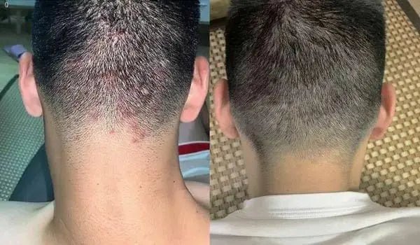 RUTHAIR 3重海鹽天然潔淨脂漏性頭皮調養洗護 洗髮水/護髮水🌟洗頭水轉咗新包裝 - HLY & CHOCCICO