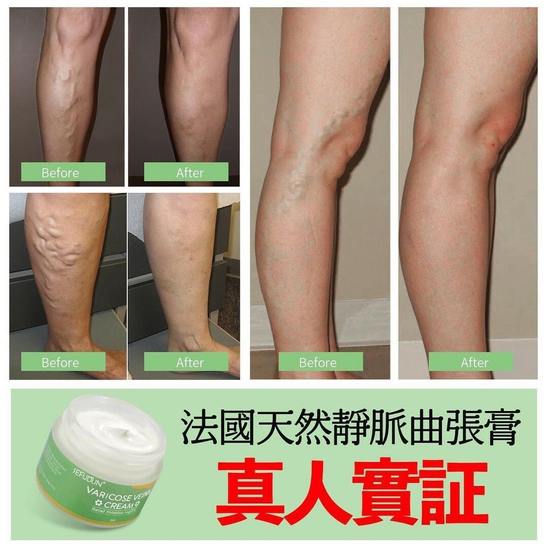 法國SEFUDUN天然靜脈曲張膏50g HLY & CHOCCICO