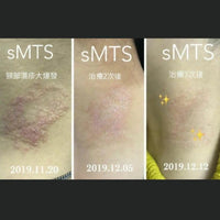 sMTS  嬰兒水晶針水光粒子面膜 (1盒5片) - HLY & CHOCCICO