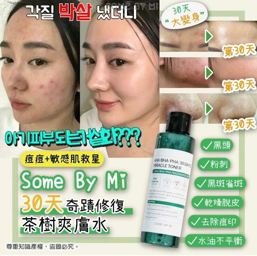 韓國 SOME BY MI 30天奇蹟爽膚水 150ml - HLY & CHOCCICO