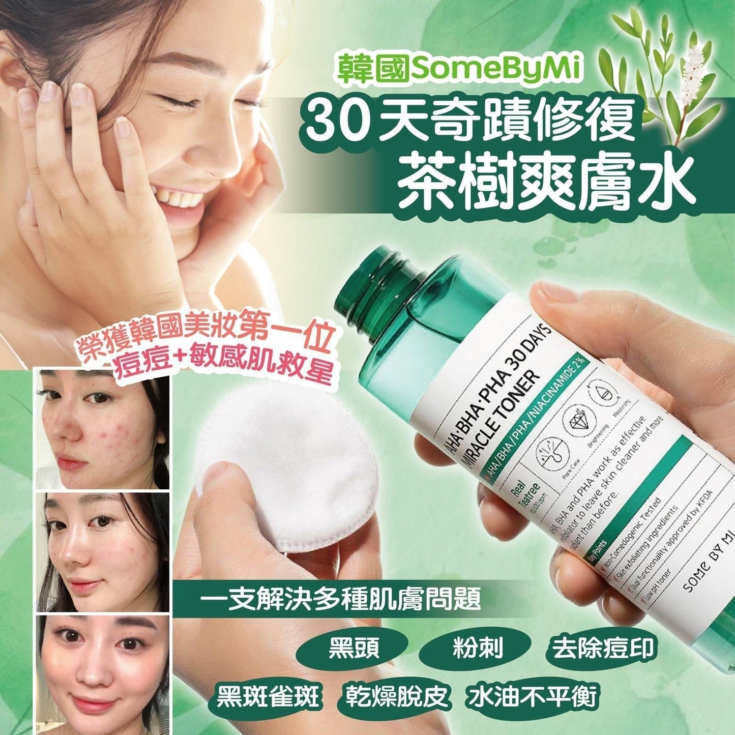 韓國 SOME BY MI 30天奇蹟爽膚水 150ml HLY & CHOCCICO