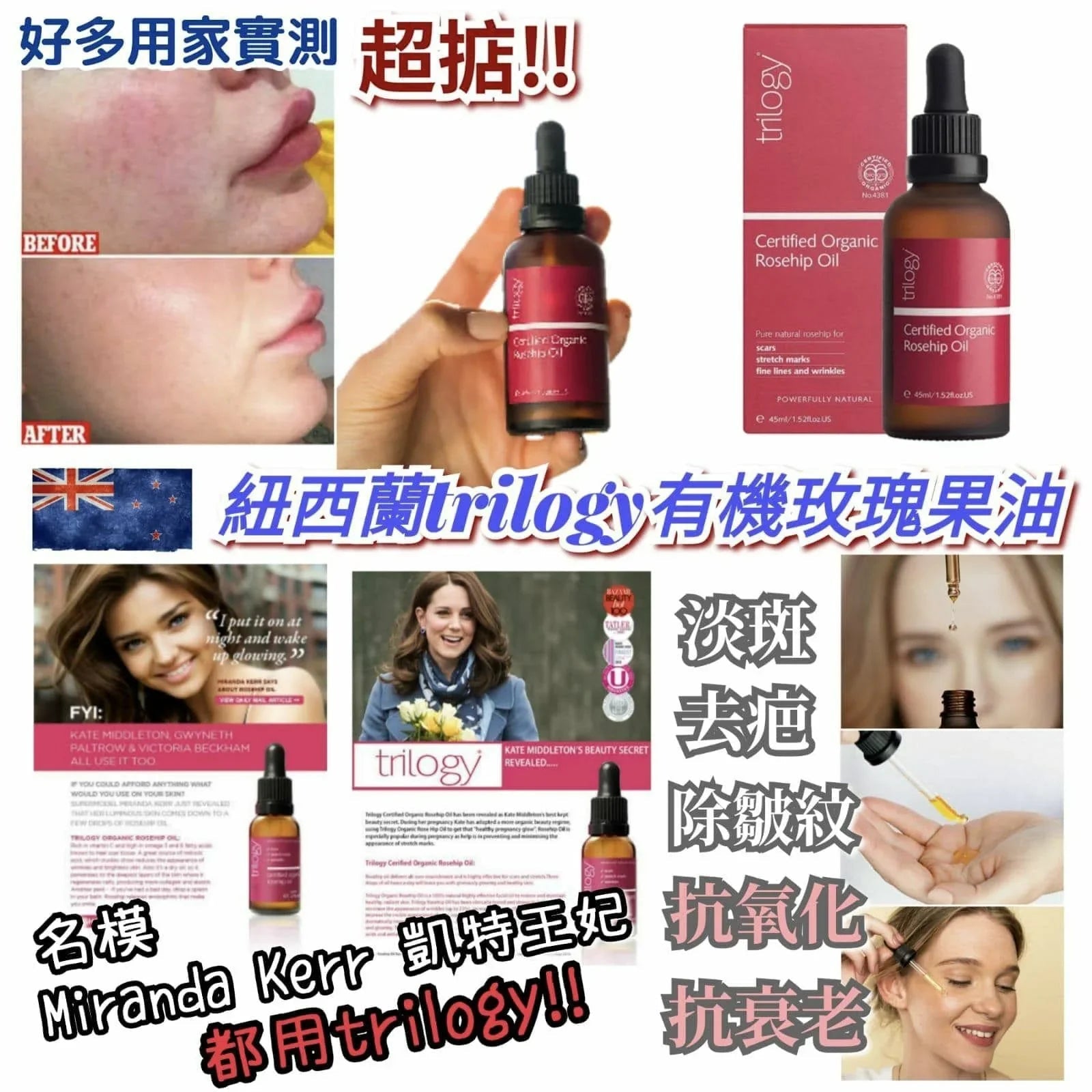 紐西蘭Trilogy認証有機玫瑰果油45ml - HLY & CHOCCICO