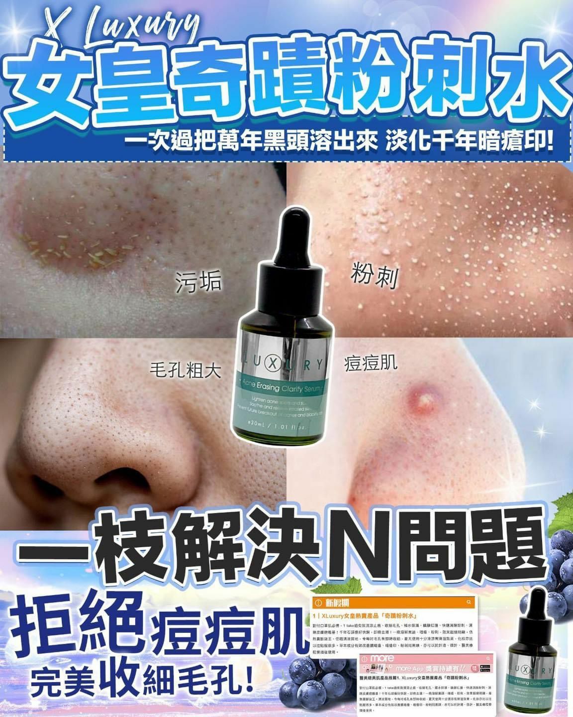 X-Luxury女皇奇蹟粉刺水 30ml - HLY & CHOCCICO