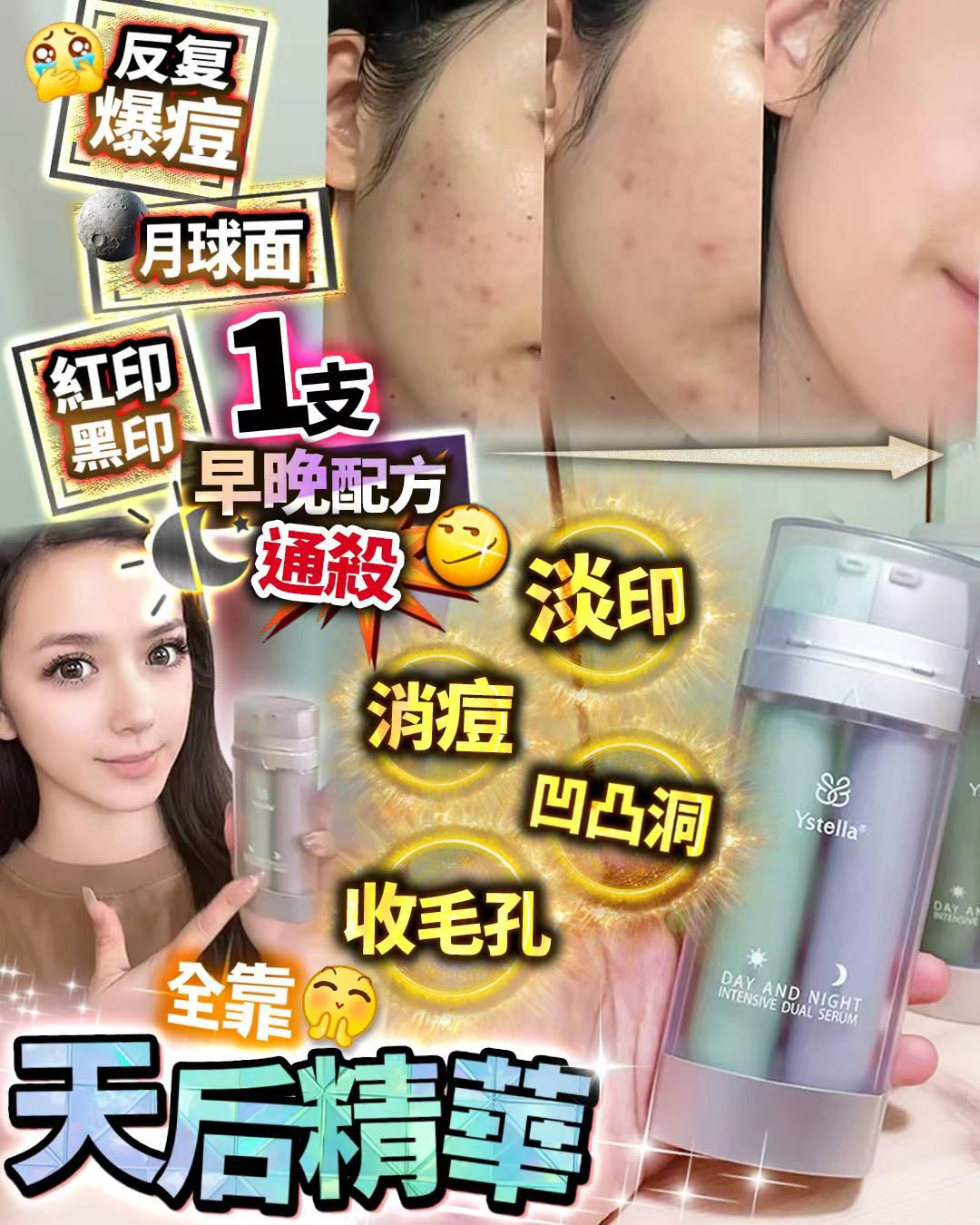 Ystella淡印天后 - HLY & CHOCCICO