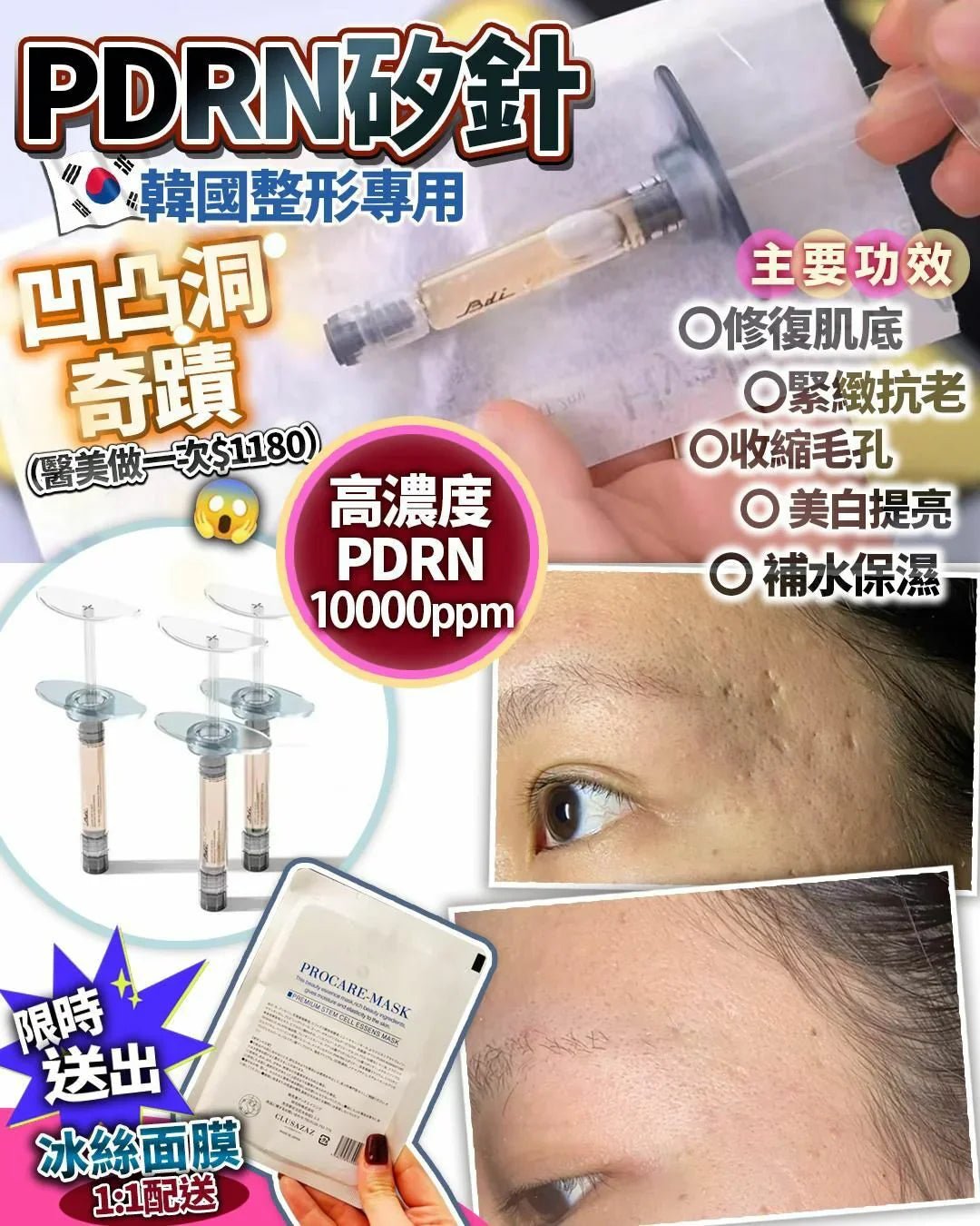 韓國高濃度10000ppm PDRN 矽針 ✨散裝 3支 （1套3支+冰絲面膜x3） - HLY &amp; CHOCCICO