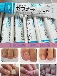 【一口價$105/支】日本🇯🇵鳥居製藥抗真菌藥膏10g |治療灰指甲/ 腳氣/ 香港腳/ 腳癬專用處方| - HLY &amp; CHOCCICO