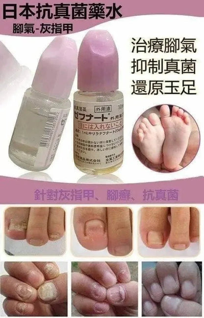 日本製🇯🇵 日本鳥居製藥抗真菌水 10ml |日本醫生大力推薦| - HLY &amp; CHOCCICO