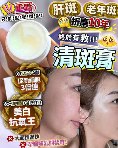 清斑膏 15g 重點塗抹 - HLY &amp; CHOCCICO