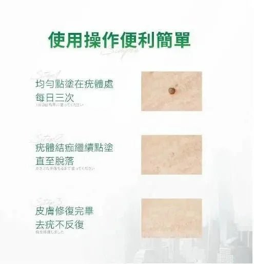 【一口價$170/支】日本🇯🇵 Healthive 除疣精華液 (10ml) - HLY &amp; CHOCCICO