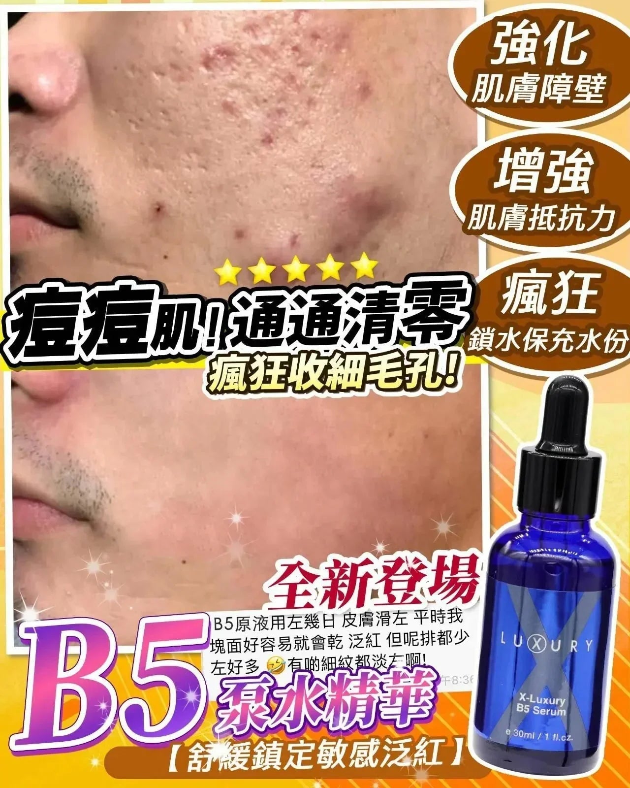 【一口價$280起/支】XLuxury肌皇 超強B5泵水精華 30ml - HLY &amp; CHOCCICO