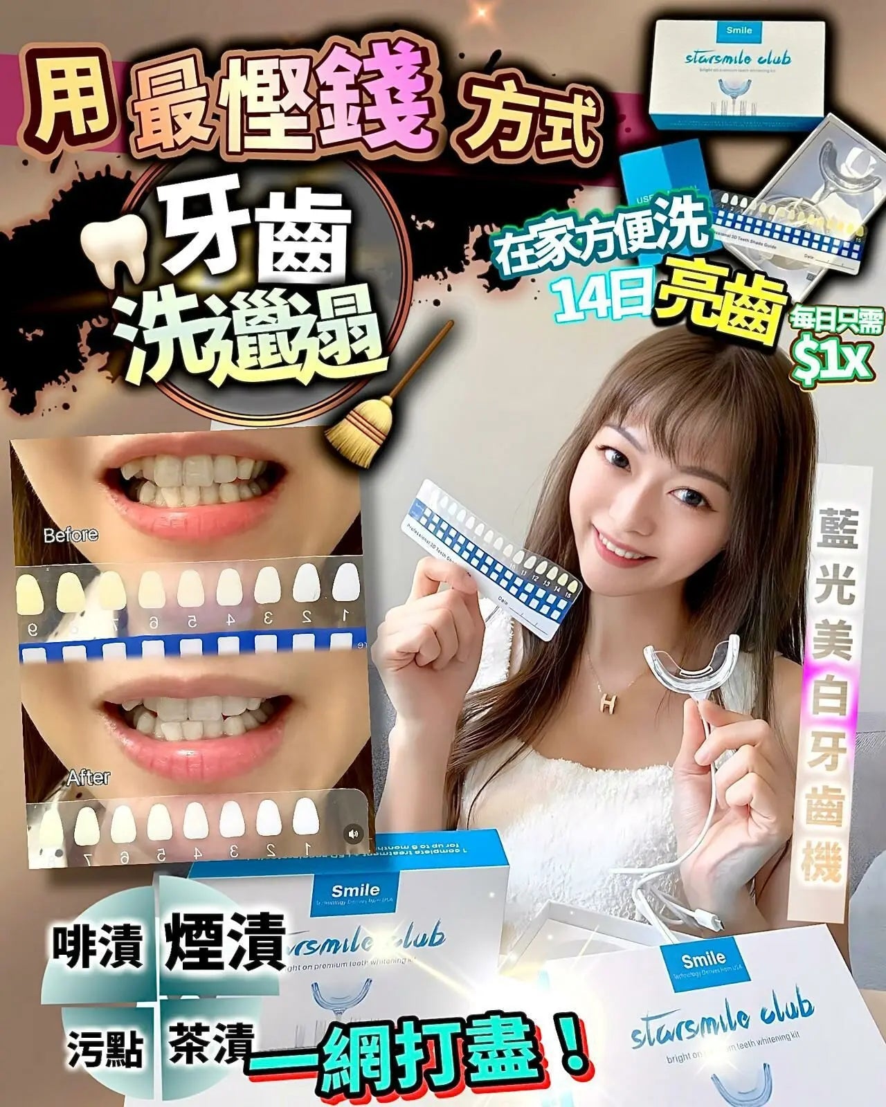 【一口價$328/部】StarSmileClub美國🇺🇸藍光美白牙齒機 HLY & CHOCCICO
