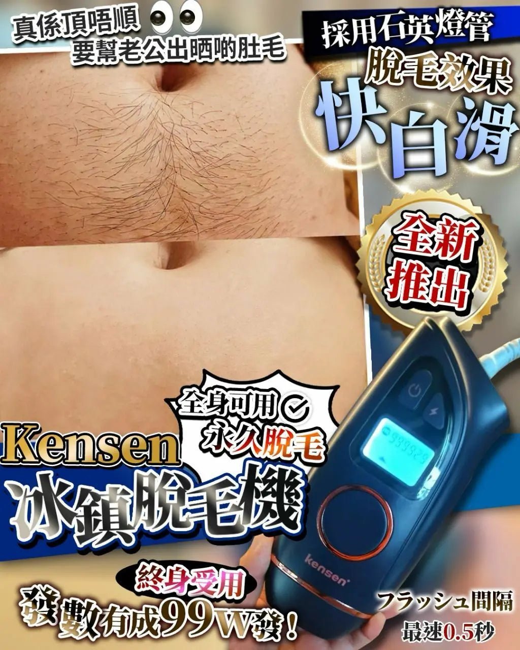 【一口價$499/部】Kensen 冰鎮脫毛機 HLY & CHOCCICO