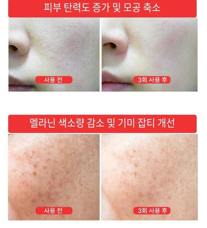 【一口價$550/套】韓國製🇰🇷 LUTHIONE白玉美白針淡斑安瓶優惠套裝 - HLY &amp; CHOCCICO