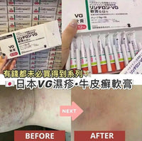 【一口價$60/支】日本VG濕疹軟膏 5g |濕疹|皮膚過敏|黑皮症|股癬|苔蘚|皮膚炎|癢疹|膿皰|紅斑| HLY & CHOCCICO