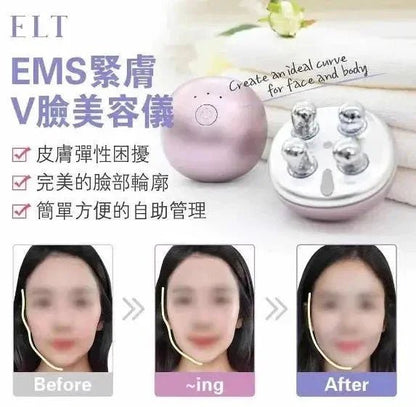 【一口價$688/部】ELT EMS 緊膚V臉美容儀 🇭🇰行貨1年保養🇭🇰 - HLY &amp; CHOCCICO
