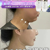 【一口價$899/套】Sliswiss 1＋2微整Hifu套裝 HLY & CHOCCICO