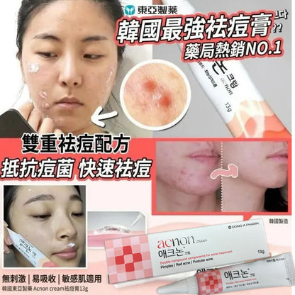 Dong-A Pharmaceutical Acnon Anti-Inflammatory and Acne Treatment Cream 13g (Korea)
