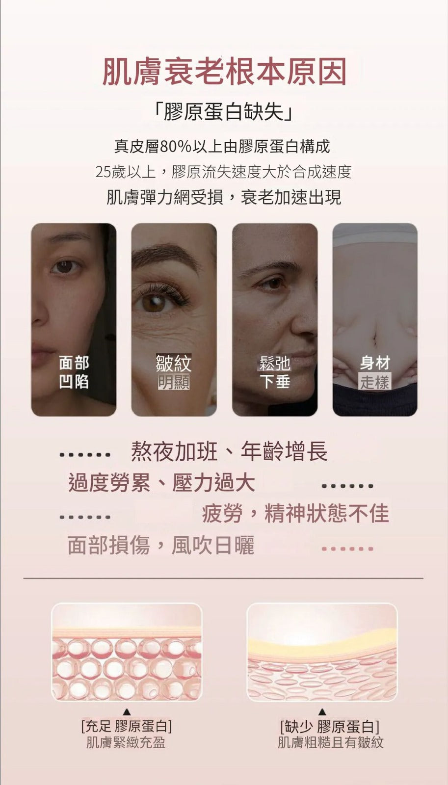 韓國熱賣🔥 ILO - Type 1 膠原蛋白安瓶 - 28日份