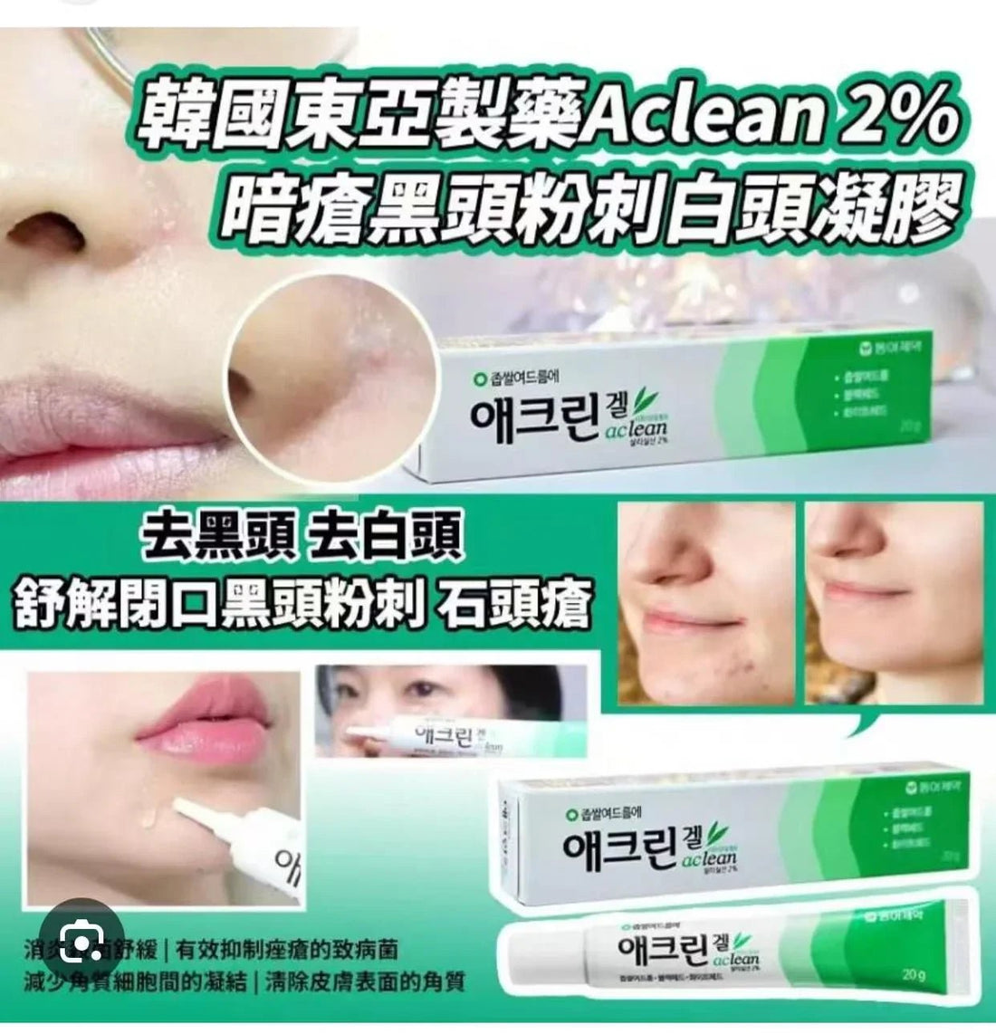 藥房 東亞製藥 Aclean 2%水楊酸去黑頭粉刺酒米凝膠啫喱 - HLY &amp; CHOCCICO